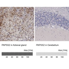 Anti-PAPSS2 Antibody