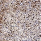 Immunohistochemical staining of human adrenal gland shows high expression.