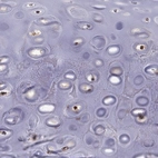 Immunohistochemical staining of human cartilage shows strong nuclear positivity in the chondrocytes.