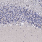 Immunohistochemical staining of human cerebellum shows low expression as expected.