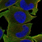 Anti-CRLF2 Antibody