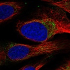 Immunofluorescent staining of human cell line U-2 OS shows localization to mitochondria.