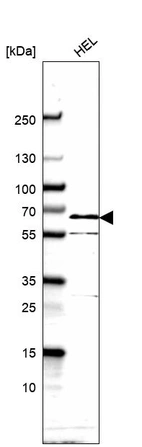 Western blot analysis in human cell line HEL.