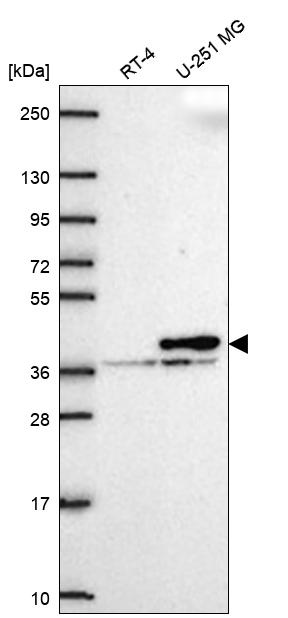 Anti-CNN2 Antibody
