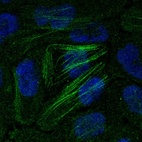 Immunofluorescent staining of human cell line RT-4 shows localization to nucleoplasm & actin filaments.