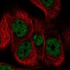 Anti-PCDHB6 Antibody