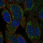 Anti-HARS2 Antibody