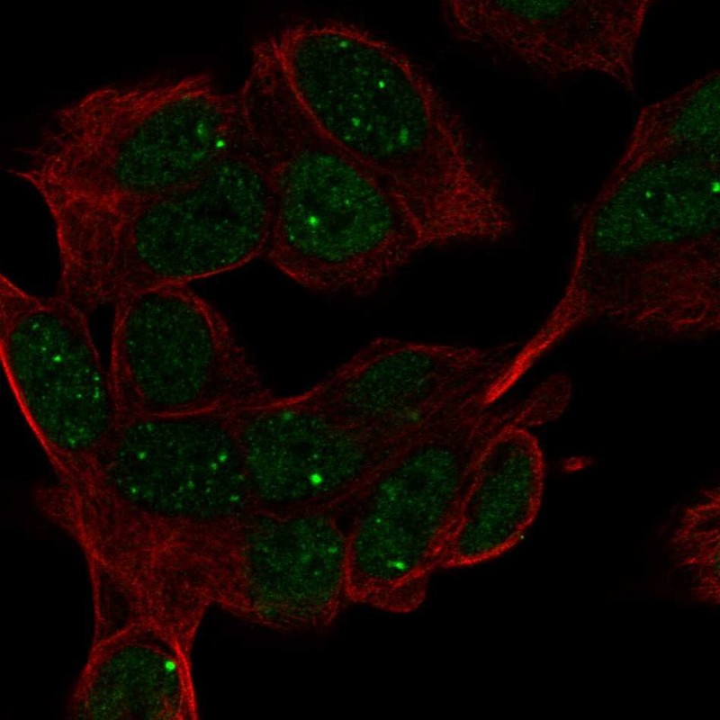 Anti-HAND1 Antibody