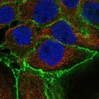 Immunofluorescent staining of human cell line A-431 shows localization to plasma membrane.