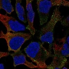 Immunofluorescent staining of human cell line AF22 shows localization to cytosol & vesicles.