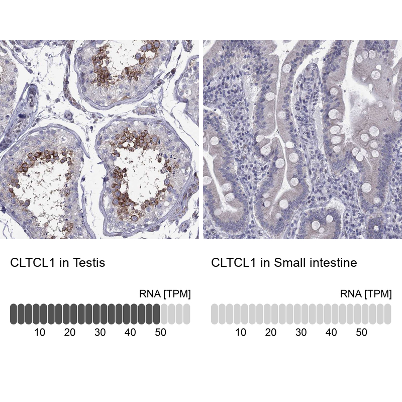 Anti-CLTCL1 Antibody