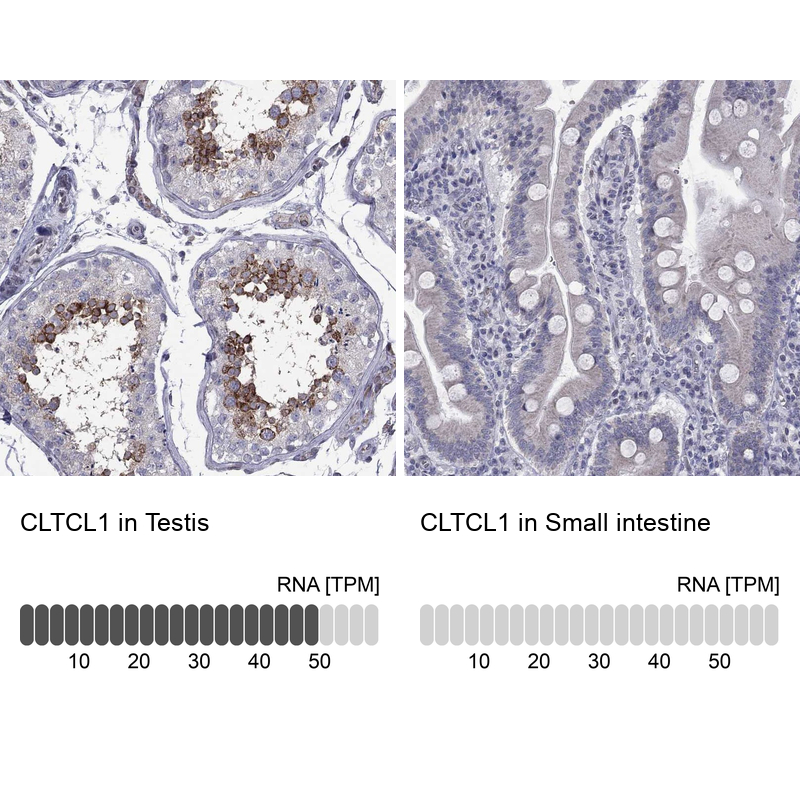 Anti-CLTCL1 Antibody