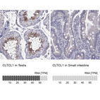 Anti-CLTCL1 Antibody