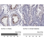 Anti-CLTCL1 Antibody