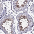 Immunohistochemical staining of human testis shows high expression.