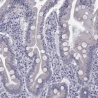 Immunohistochemical staining of human small intestine shows low expression as expected.