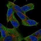 Anti-MAP3K7 Antibody