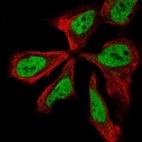 Immunofluorescent staining of human cell line AF22 shows localization to nucleoplasm.
