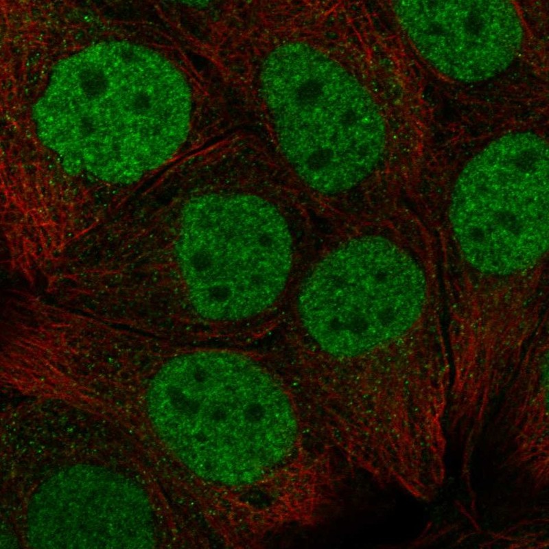 Anti-CBX6 Antibody