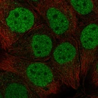 Anti-CBX6 Antibody