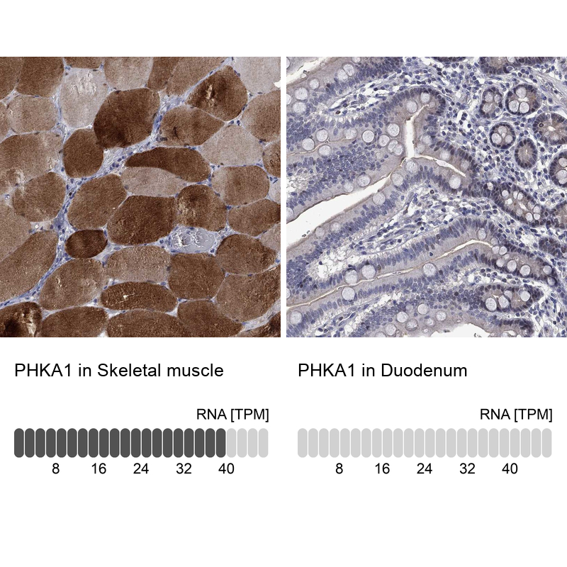 Anti-PHKA1 Antibody