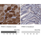 Anti-PHKA1 Antibody