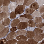 Immunohistochemical staining of human skeletal muscle shows high expression.