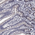 Immunohistochemical staining of human duodenum shows low expression as expected.