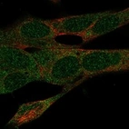 Anti-SDR39U1 Antibody
