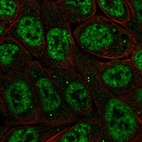 Anti-NFKBIZ Antibody