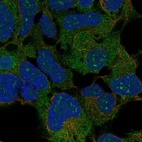 Anti-RPLP2 Antibody