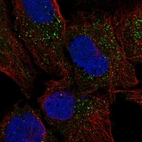 Anti-CRISPLD2 Antibody