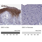 Anti-DSC1 Antibody