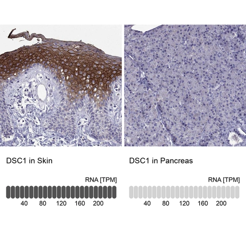 Anti-DSC1 Human Protein Atlas Antibody