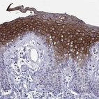 Immunohistochemical staining of human Skin shows strong membranous positivity in squamous epithelial cells.