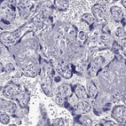 Immunohistochemical staining of human Placenta shows no positivity in trophoblastic cells as expected.