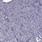 Immunohistochemical staining of human Pancreas shows no positivity in exocrine glandular cells as expected.
