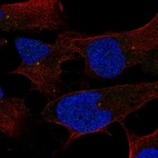 Anti-ST7L Antibody