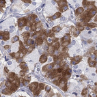 Anti-MYO3A Antibody