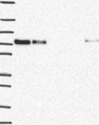 Lane 1: Marker [kDa] 250, 130, 95, 72, 55, 36, 28, 17, 10 | Lane 2: RT4 | Lane 3: U-251 MG | Lane 4: Human Plasma | Lane 5: Liver | Lane 6: Tonsil