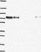 Lane 1: Marker [kDa] 250, 130, 95, 72, 55, 36, 28, 17, 10 | Lane 2: RT4 | Lane 3: U-251 MG | Lane 4: Human Plasma | Lane 5: Liver | Lane 6: Tonsil