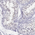Immunohistochemical staining of human testis shows high expression.