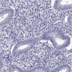 Immunohistochemical staining of human endometrium shows low expression as expected.