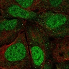 Anti-AGO3 Antibody