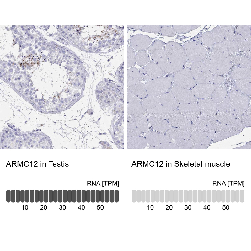 Anti-ARMC12 Antibody