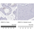 Anti-ARMC12 Antibody