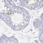 Immunohistochemical staining of human testis shows high expression.