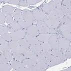 Immunohistochemical staining of human skeletal muscle shows low expression as expected.