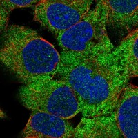 Anti-ZBTB45 Antibody