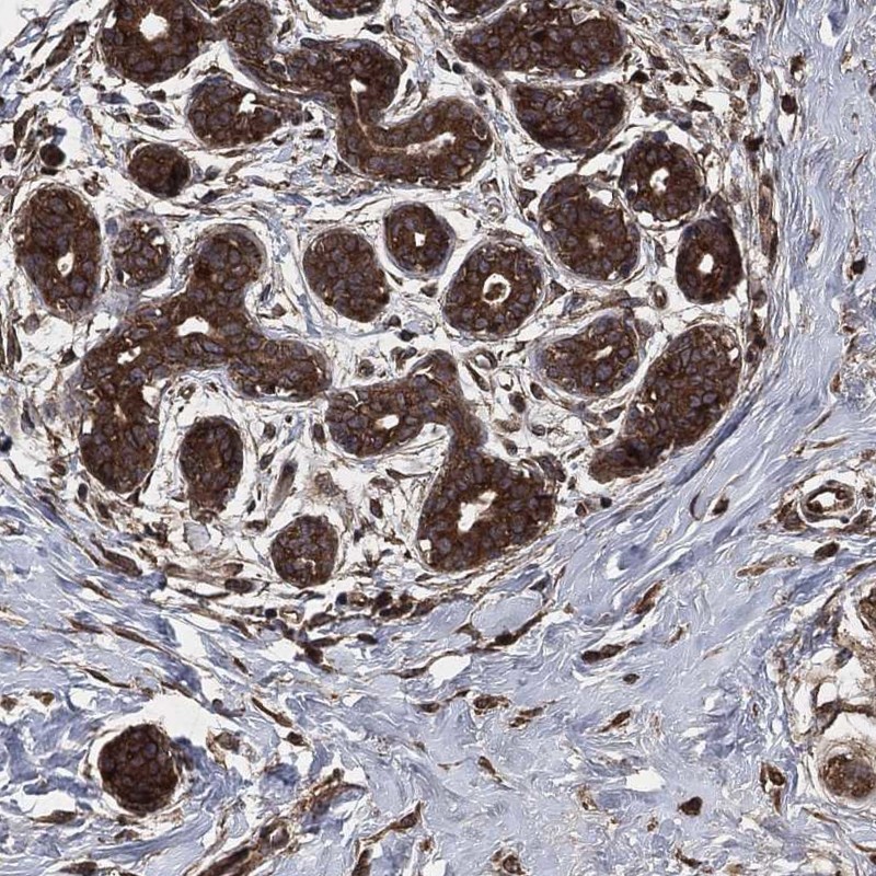 Anti-AKT1S1 Antibody